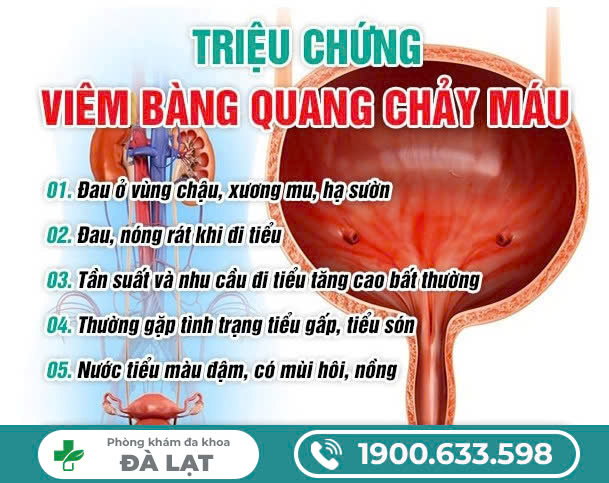 Hình ảnh minh họa